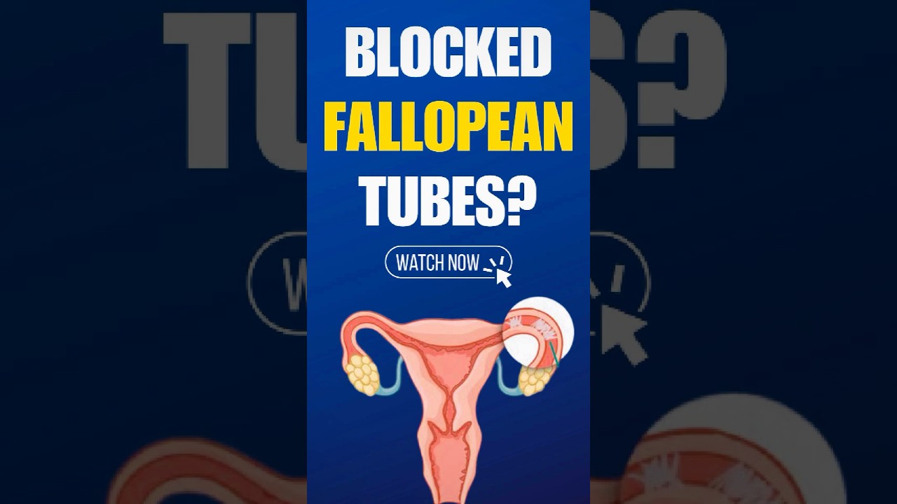 Blocked Fallopian Tubes? Here&rsquo;s How to Treat Them!