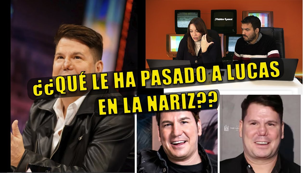 ¿Qué le ha pasado a Lucas? La verdad de su nariz.