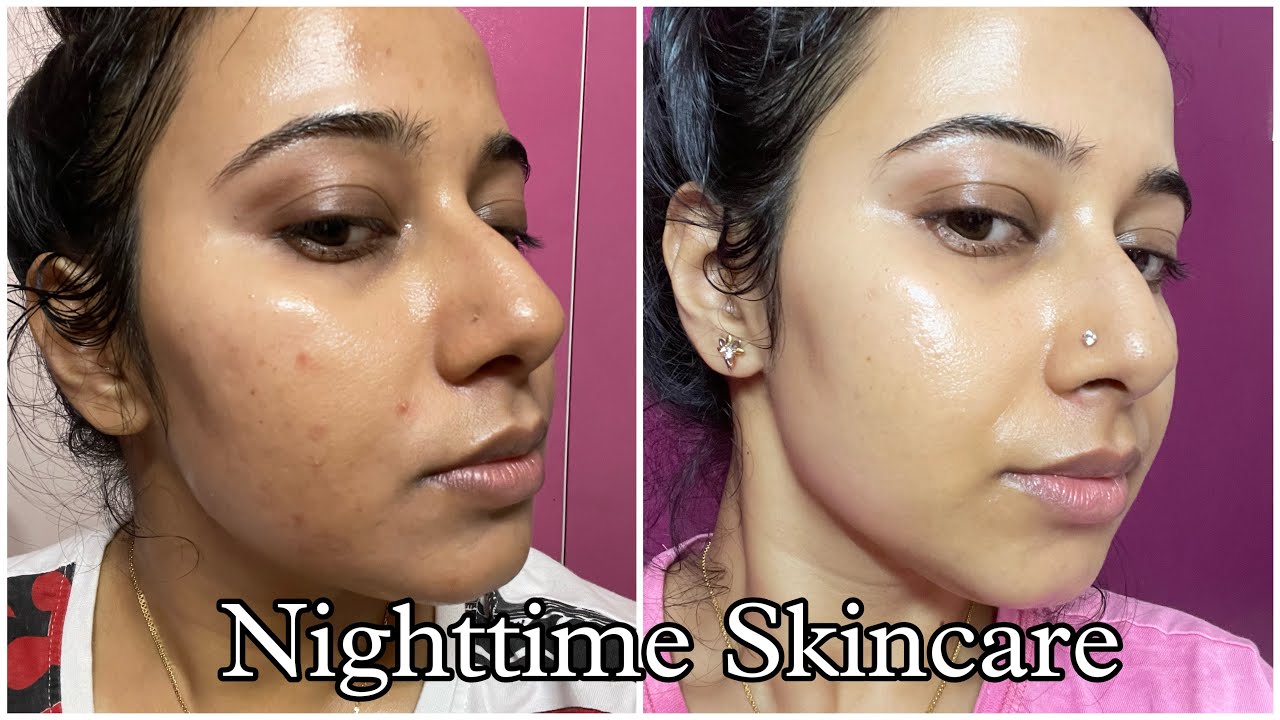 “Unsponsored” 7 Days Tretinoin Skincare Routine for Acne free Glowing skin