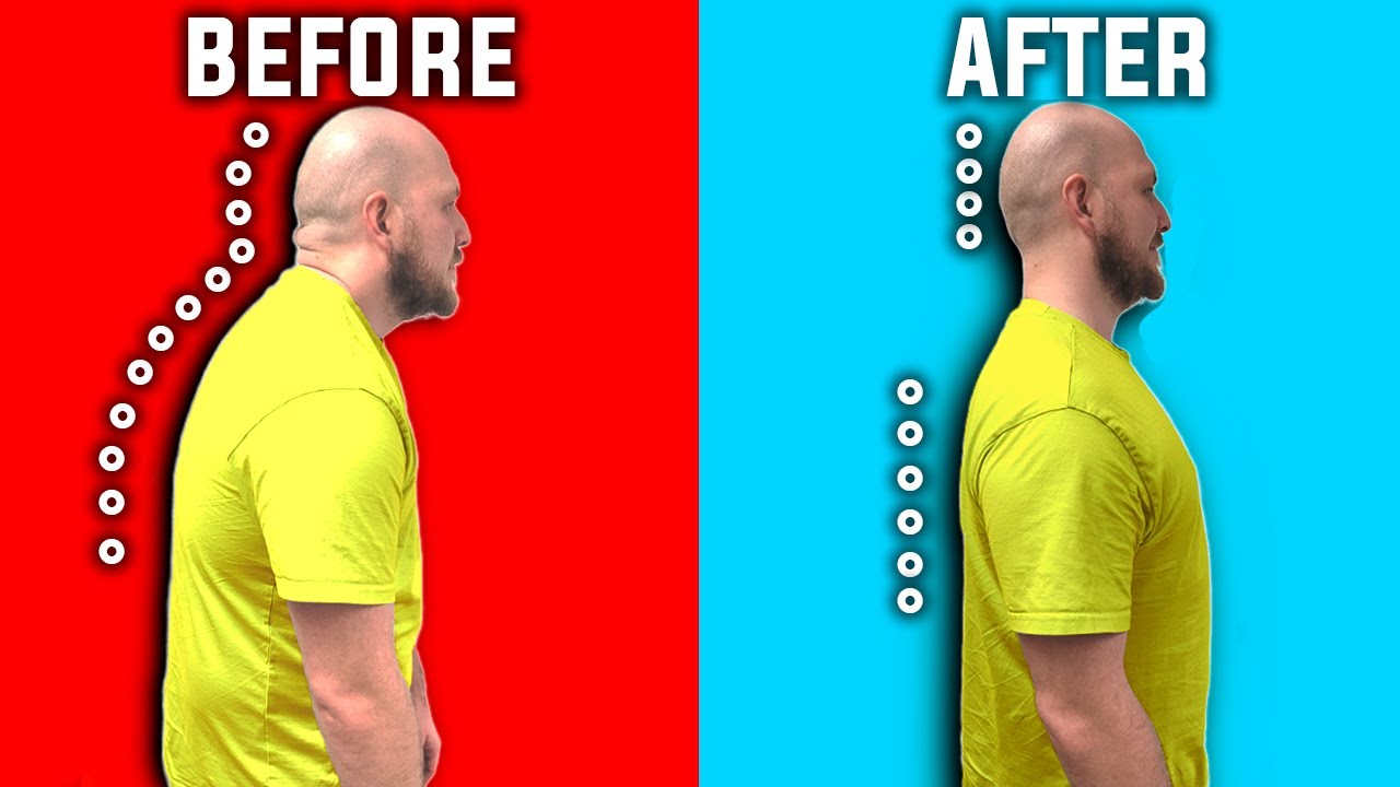 Transform your posture with only ONE stretch!