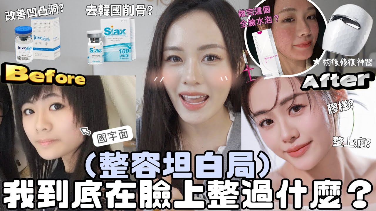 【💉整容坦白局】我到底做過什麼醫美項目⁉️操作過程全公開🫣術後快速修復護理tips💫 [實測十分鐘白3度神器!!]