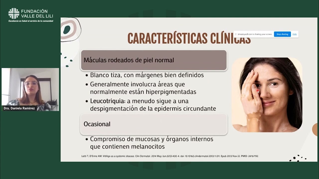 Vitíligo - Dra. Daniela Ramírez | Jornada Académica Dermatología No. 54