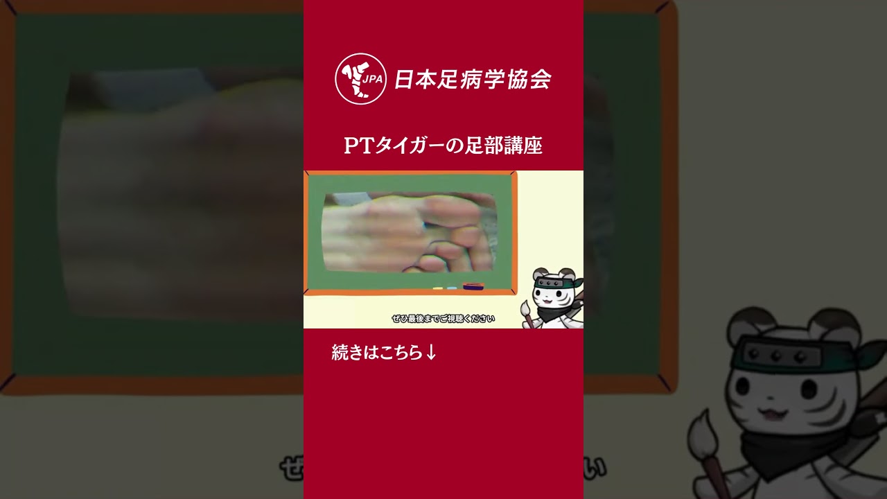 【保存版】これで迷わない！胼胝（たこ）徹底解説