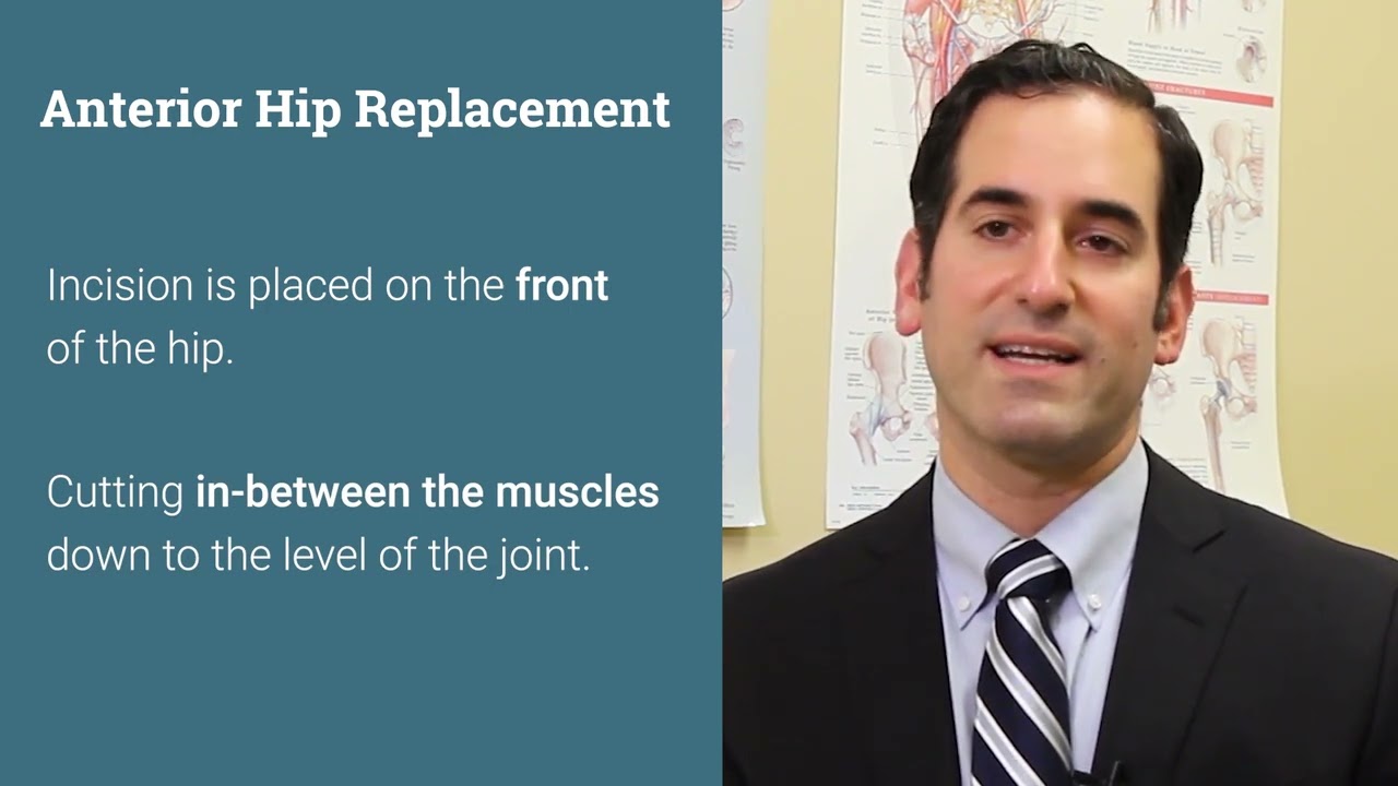 Ask An Expert: What's the difference between an Anterior and a Posterior Hip Replacement?
