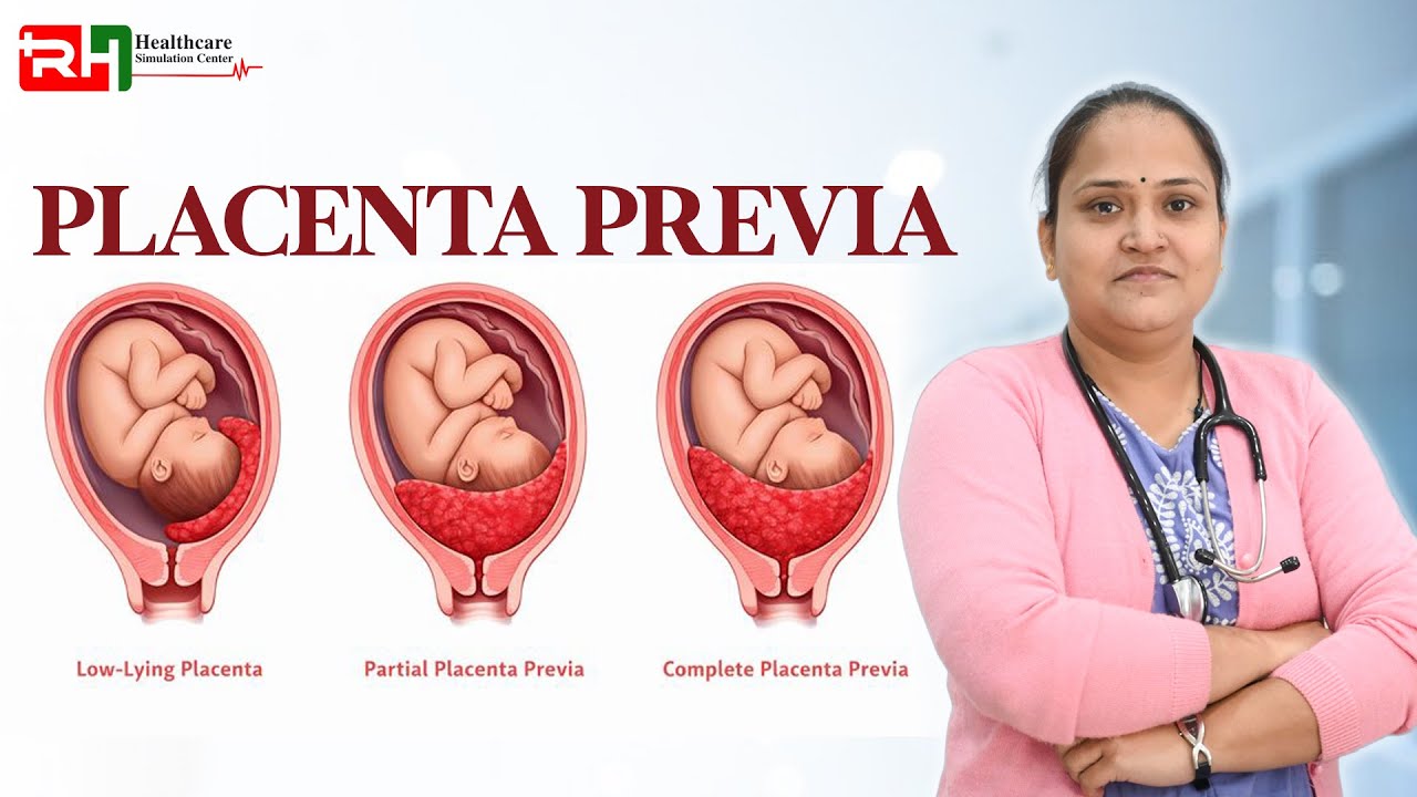 Placenta Previa 🚨🤰 | Obstetric Emergency Explained #PlacentaPrevia #ObstetricEmergency #Pregnancy