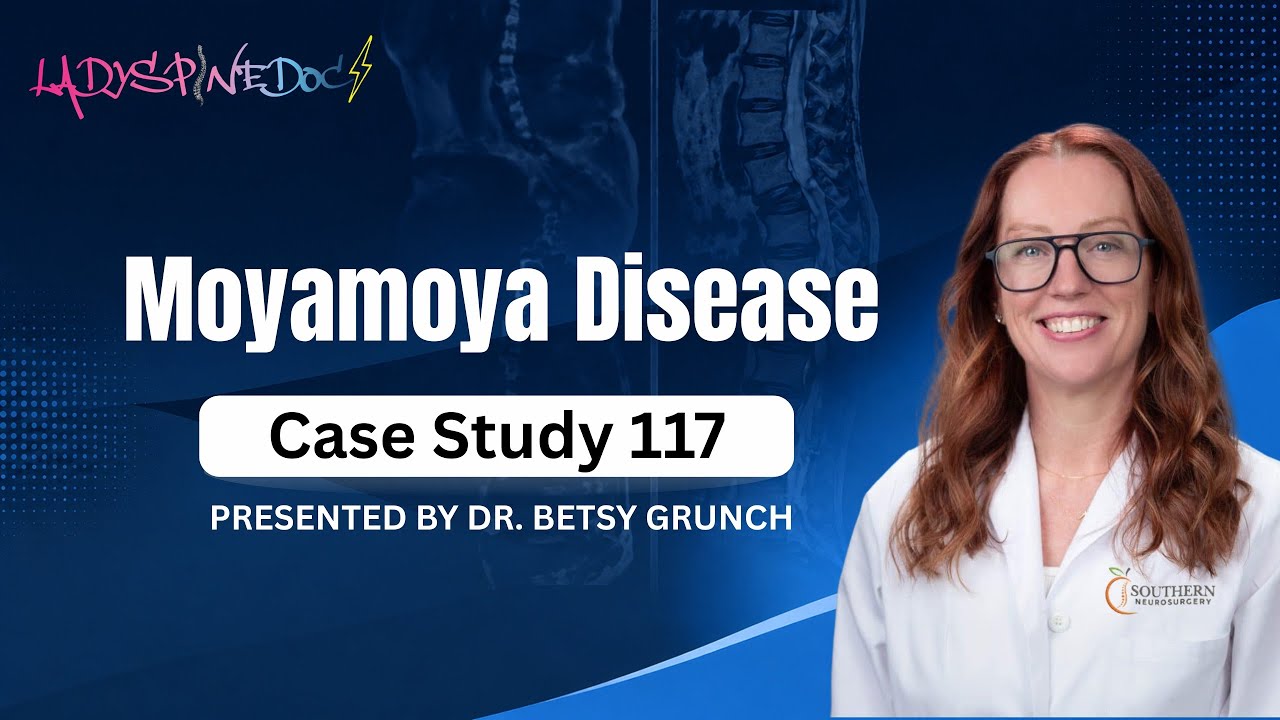 Case study 117 - Moyamoya disease, a chronic & progressive condition of the arteries in the brain