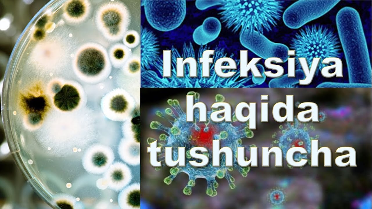 Infeksiya