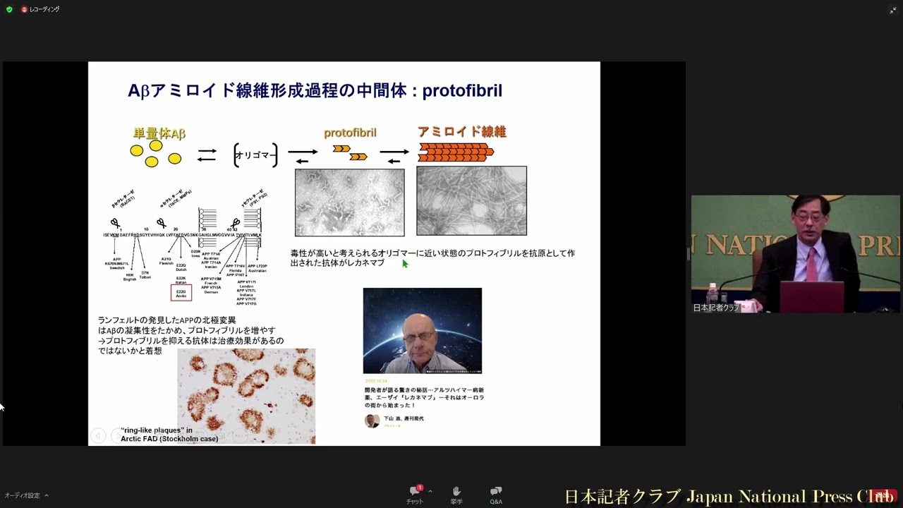「レカネマブとこれからの認知症治療」岩坪威・東京大学大学院教授  2023.1.25