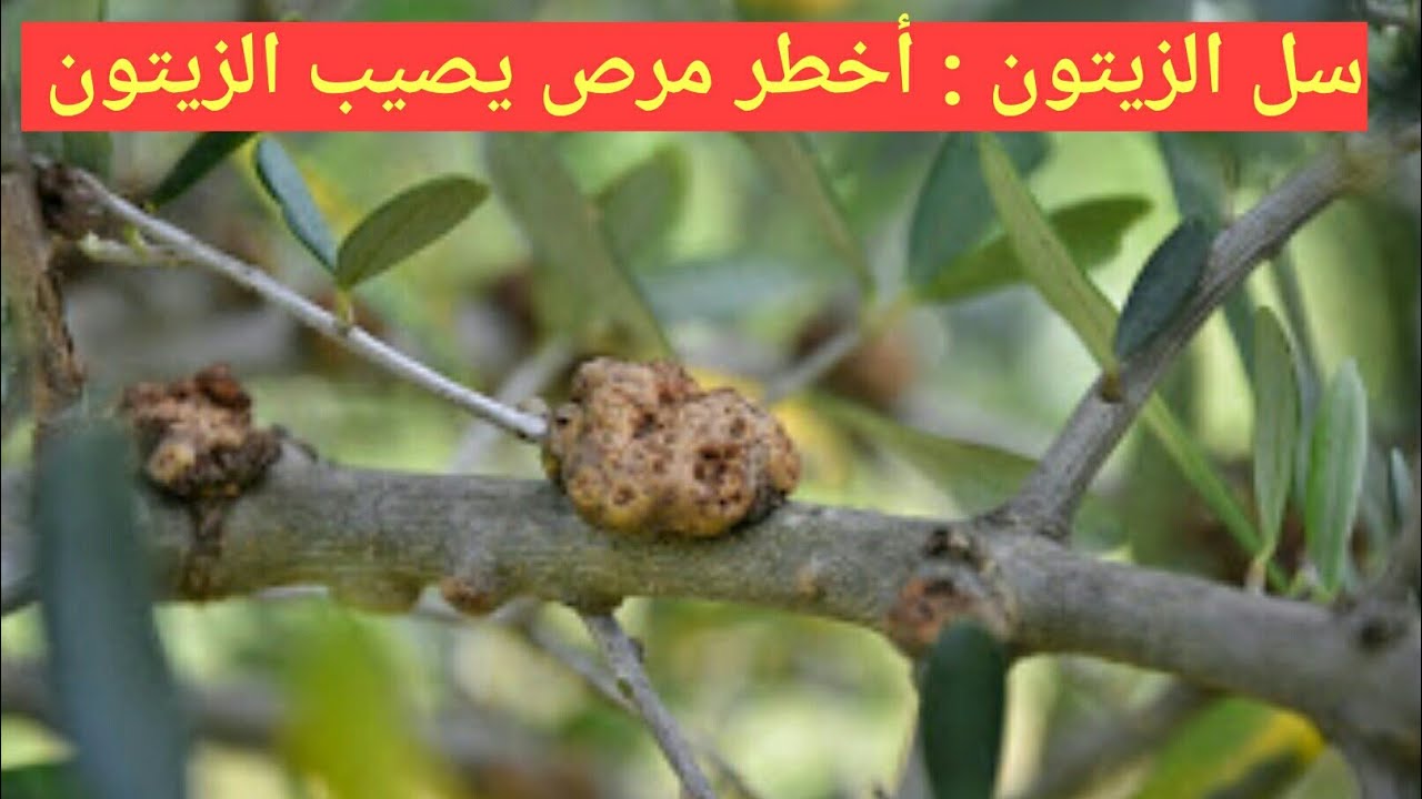 سل الزيتون أو ثألول الزيتون  (العقد الدرنية ) : هل يوجد له علاج ؟