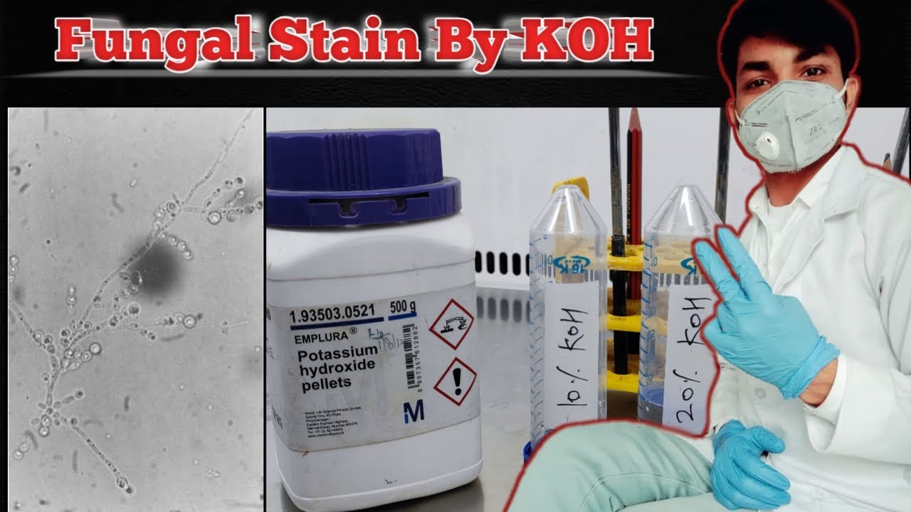 fungal stain by KOH | fungal stain KOH | KOH mount | fungal staining procedure | Potassium hydroxide