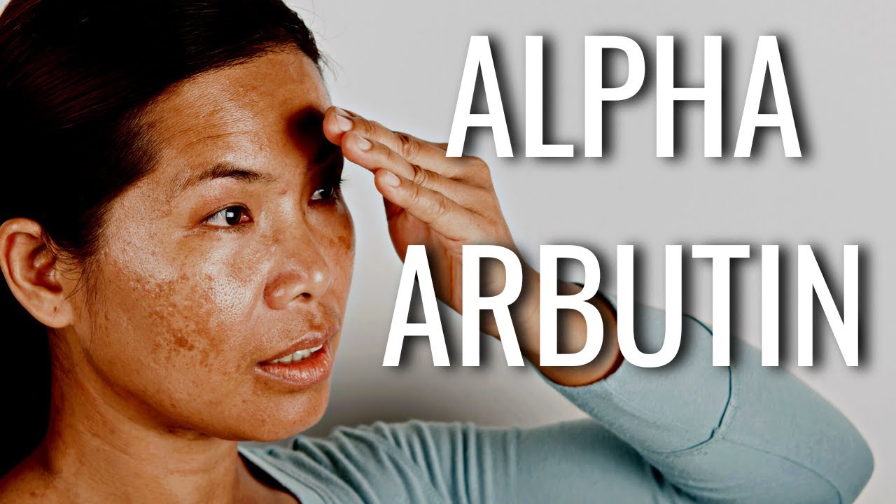 Put Alpha Arbutin On Your Dark Spots & SEE What Happens!