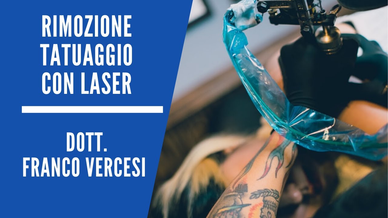 Rimuovere i tatuaggi con il laser a Picosecondi - Dott. Franco Vercesi