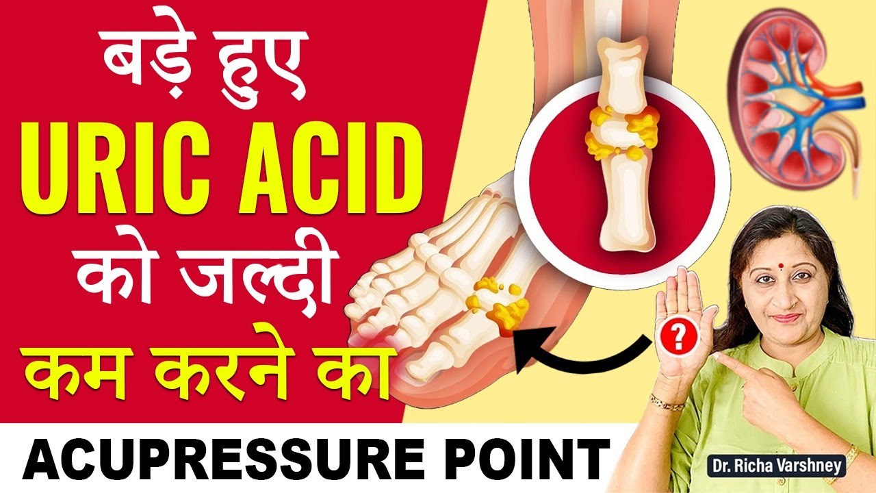 Uric Acid Home Treatment In Hindi || Uric Acid Home Treatment Acupressure Point