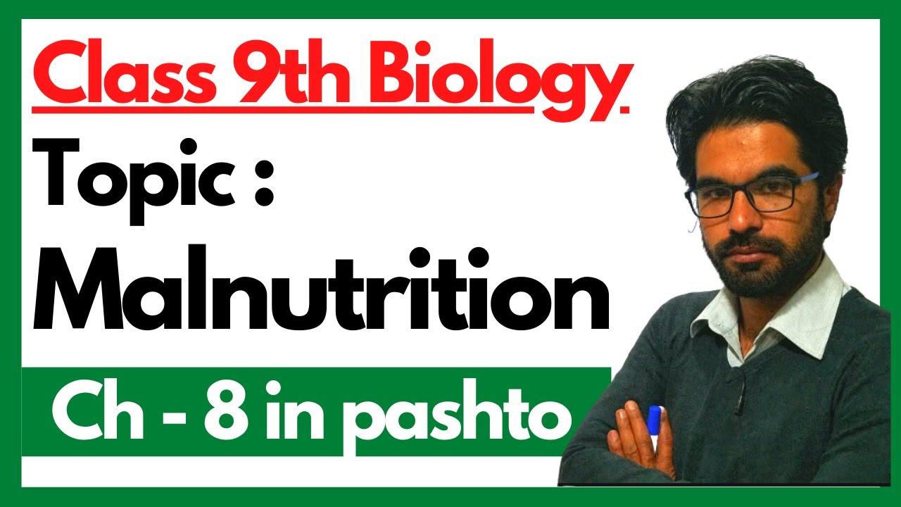 Malnutrition and its types | Home Of Biology