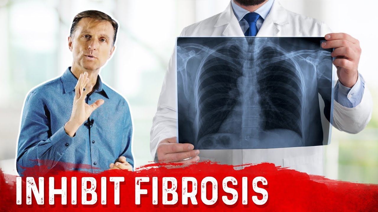 Vitamin E Inhibits Scar Tissue – Benefits of Vitamin E for Fibrosis – Dr.Berg