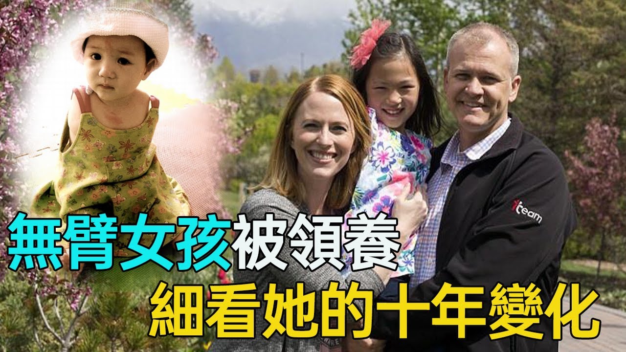 美國夫婦收養中國無臂女孩，十年過去，她用腳舞出精彩人生！