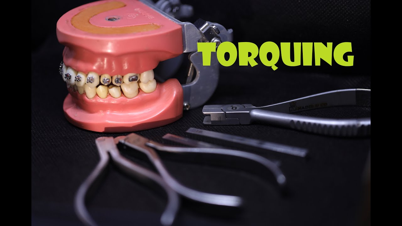 wire binding ( Torquing )