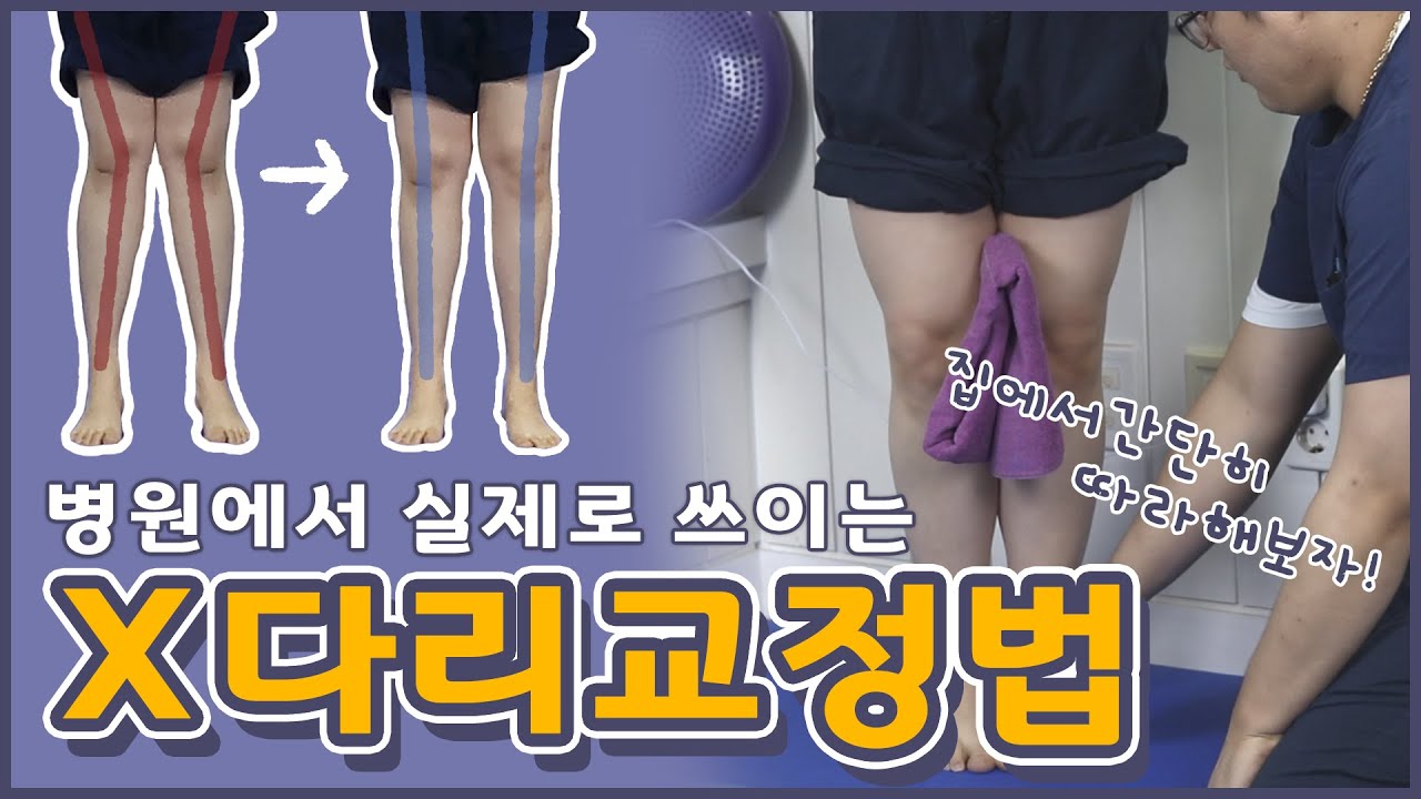 [3분투자]집에서 혼자하는 X다리 휜다리 교정!| 정파카