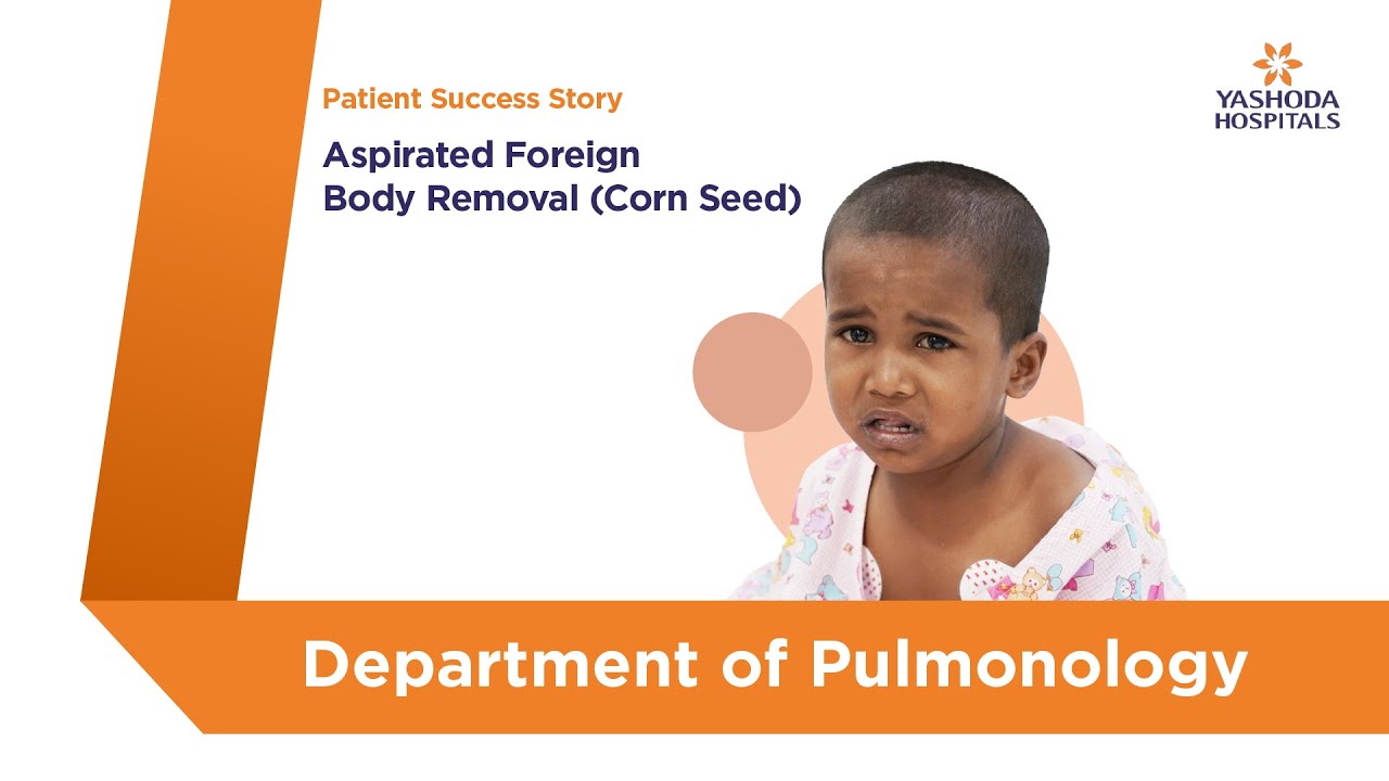Aspirated Foreign Body Removal (Corn Seed) | Yashoda Hospitals Hyderabad