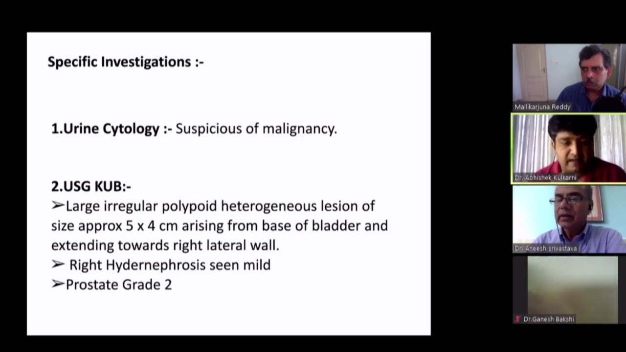 Muscle Invasive Bladder Carcinoma || FCPS Part 2 Urology Viva Practice || Urology ||