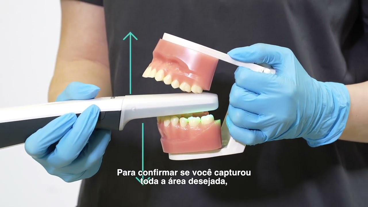 Novidades: Escaneando o scanner iTero Lumina™