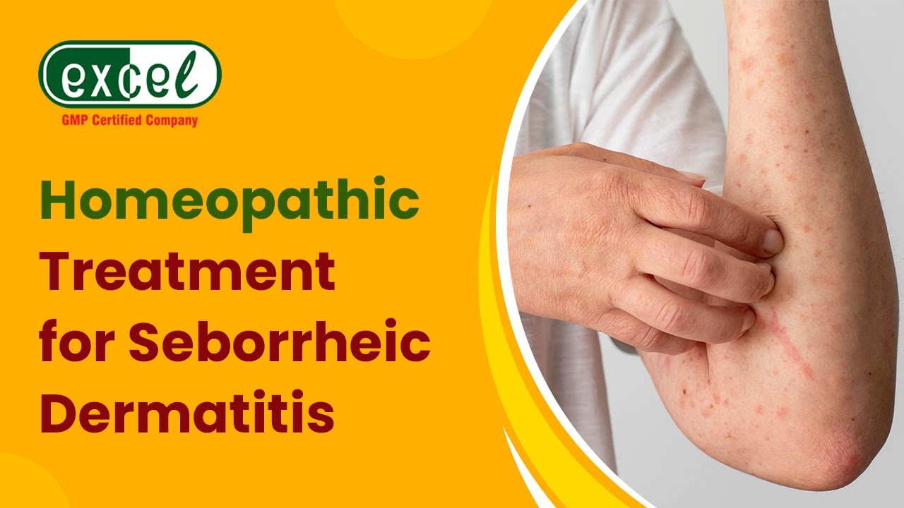 Best Homeopathic Medicines & Treatment for Seborrheic Dermatitis - An Insight by Dr. Anu Kant Goyal