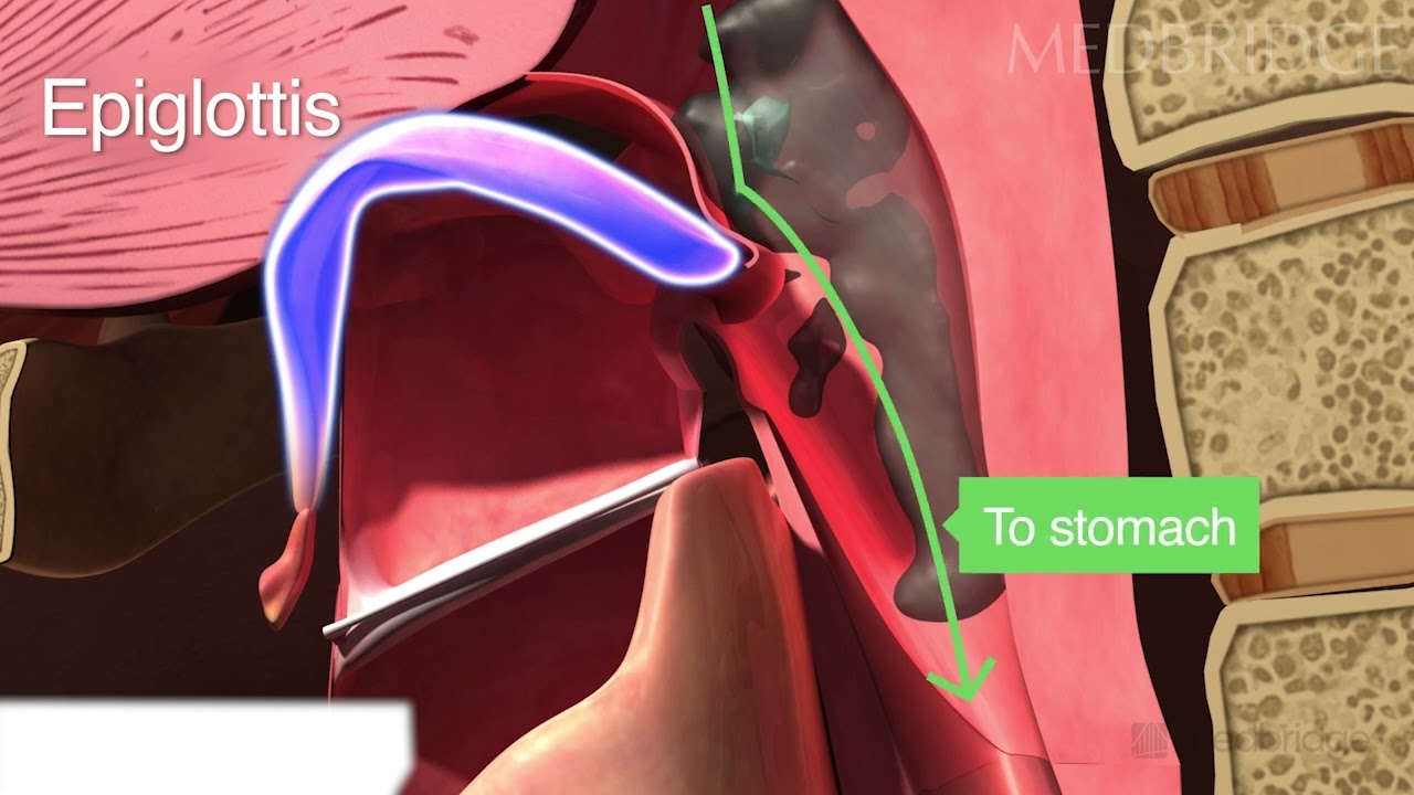 Aspiration During Swallow - Patient Education | Medbridge