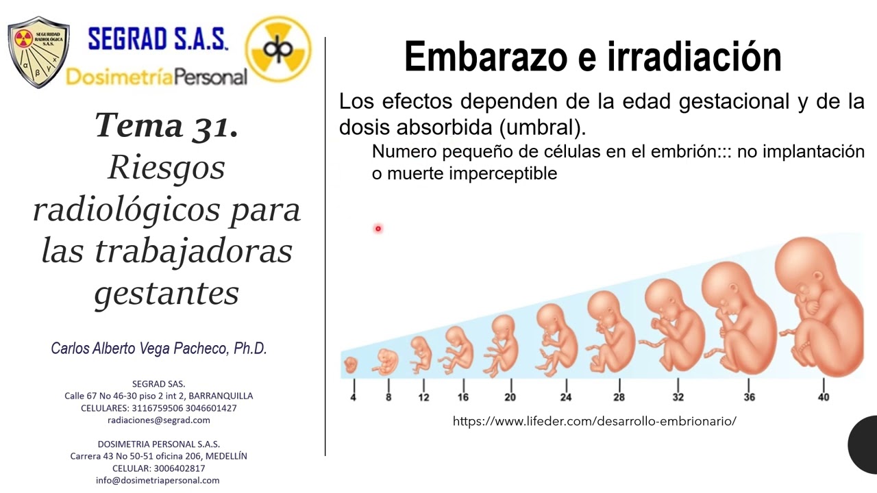Tema 31 Riesgo radiológico para las trabajadoras gestantes