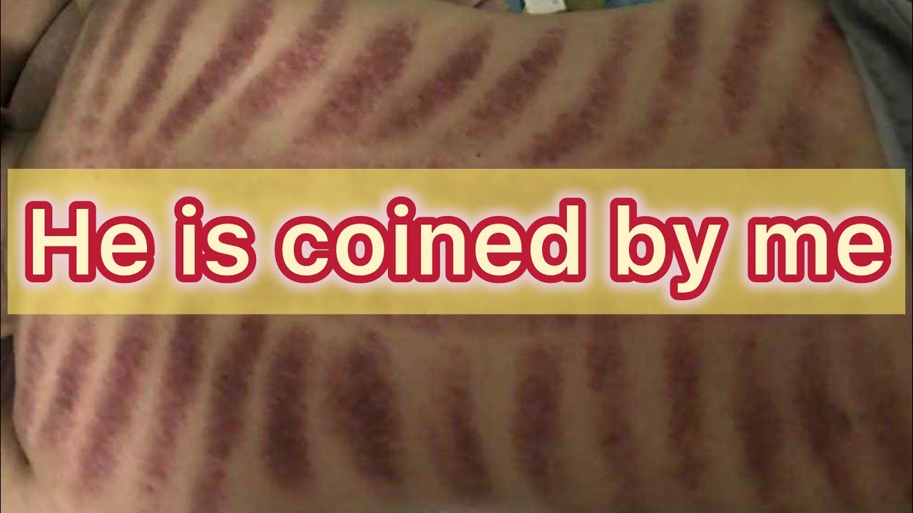 My good friend gets healed 