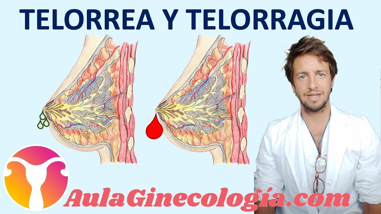 TELORREA: SECRECI&Oacute;N POR EL PEZ&Oacute;N y GALACTORREA, causas y tratamiento  - Ginecolog&iacute;a y Obstetricia -