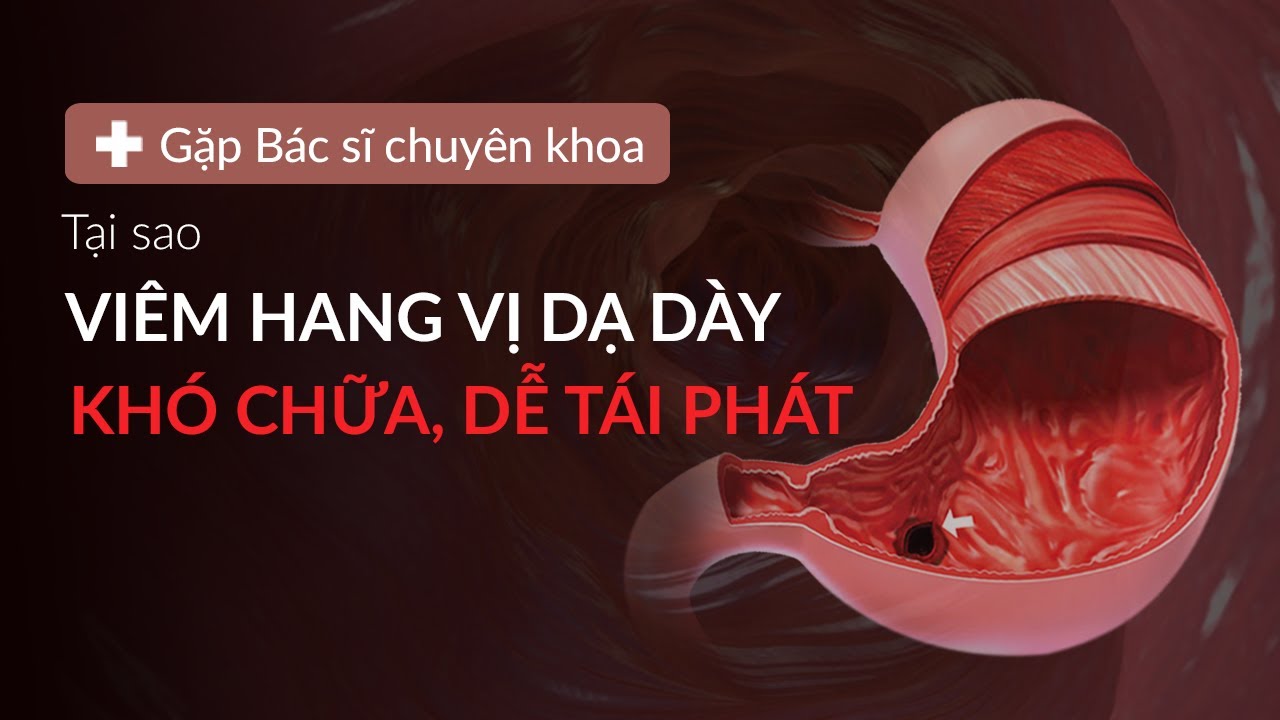 Tại sao viêm hang vị dạ dày khó chữa dễ tái phát - GBSCK Số 8