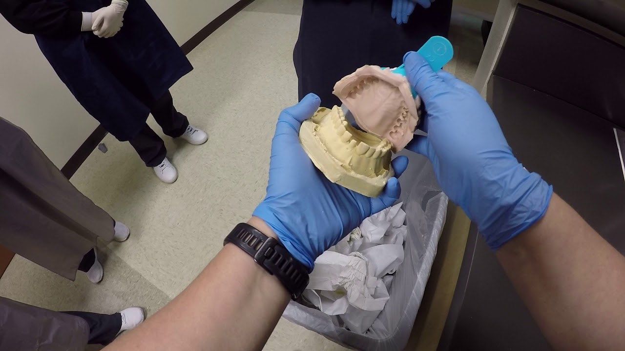 How to remove your study model from the impression tray (taken on a typodont in lab)