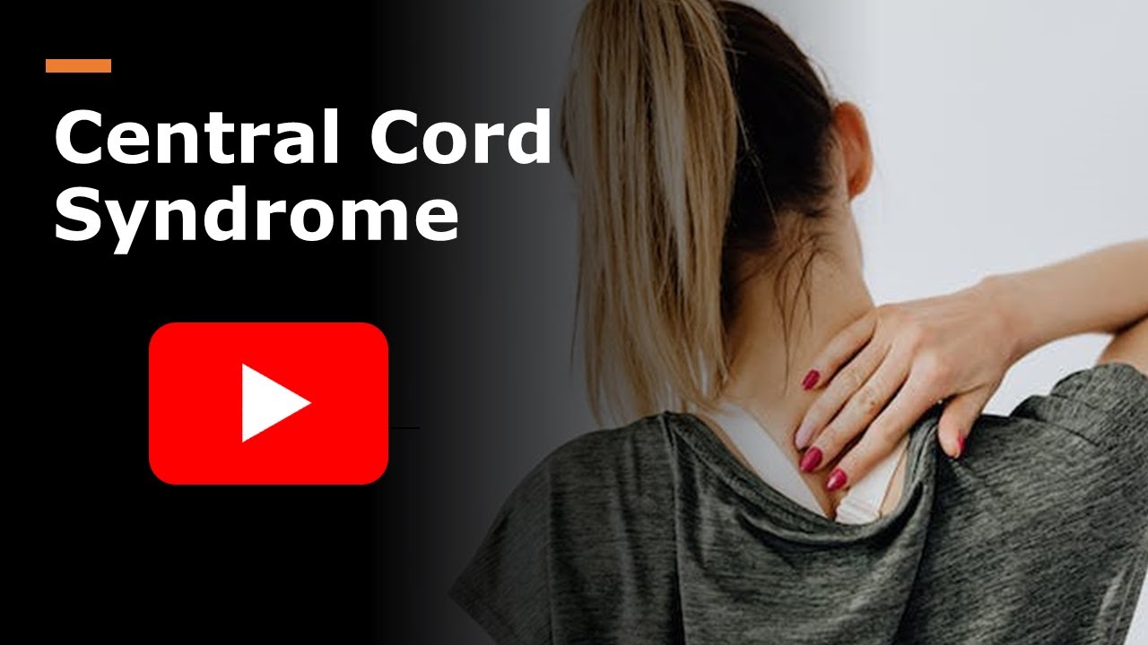 Central cord syndrome