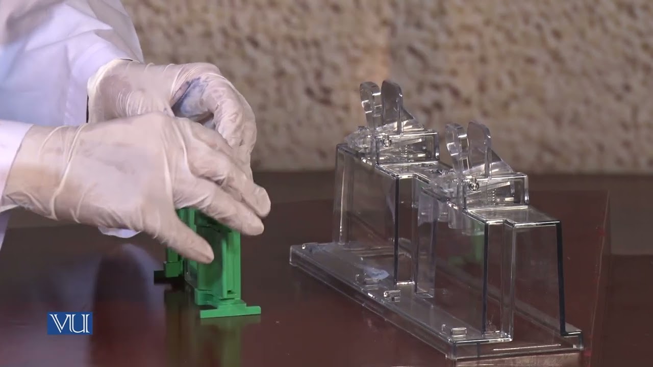 Analysis of Protein by SDS | Methods in Molecular Biology (Practical) | MB504P_Topic014