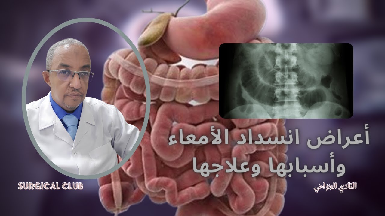 ٍSmall bowel obstruction | أعراض انسداد الأمعاء
