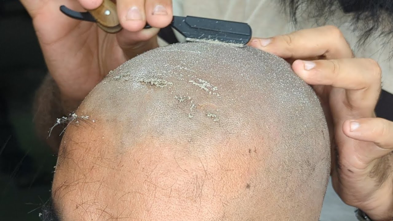 Too much hot and dirty dandruff clean head shave tutorial zaibi barber shop