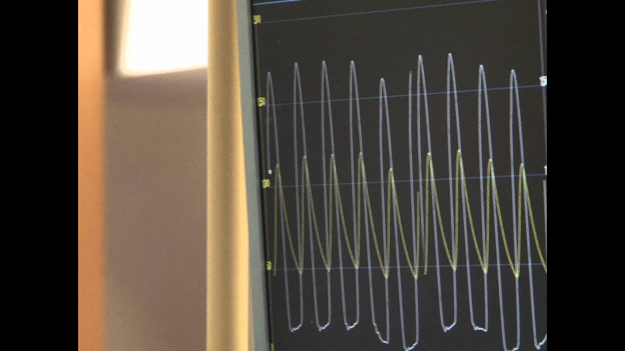 החלפת מסתם אאורטלי על ידי צנתור Aortic Valve