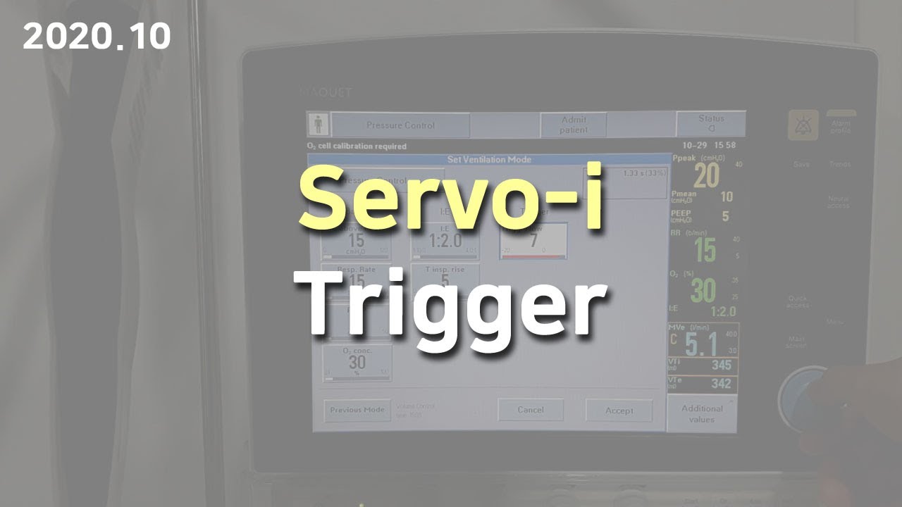 Servo-i trigger (flow triggering/pressure triggering) trigger sensitivity
