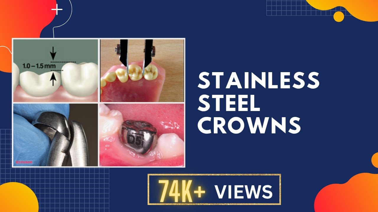 PEDIATRIC DENTISTRY | STAINLESS STEEL CROWNS