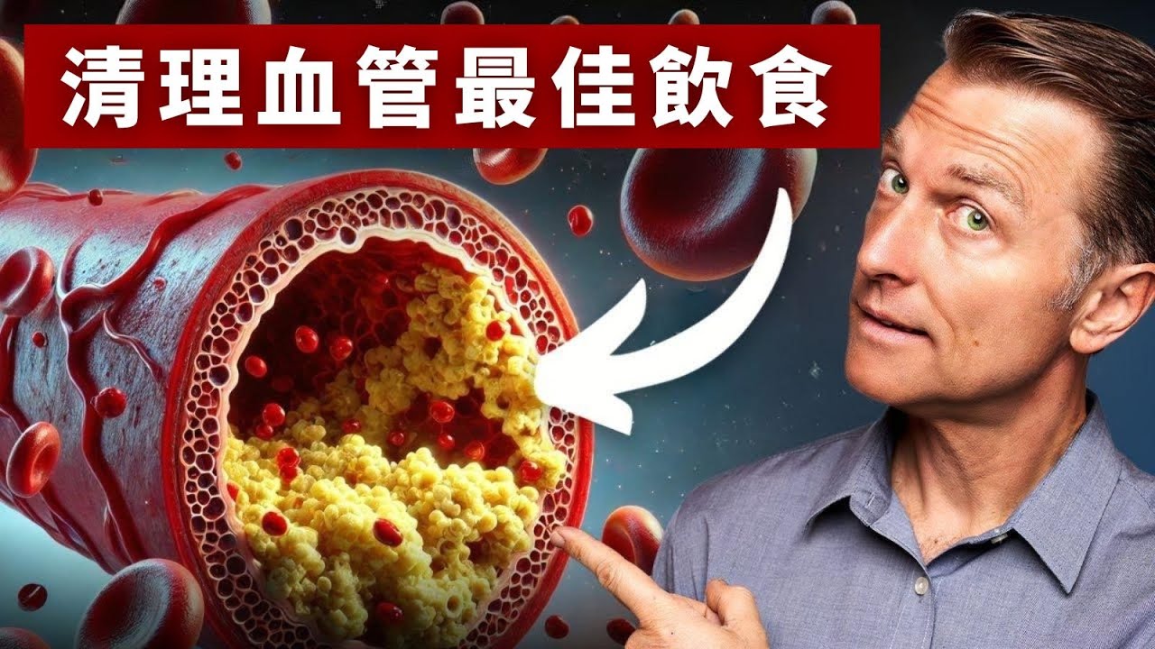 清理血管的最佳飲食,要補D3k2,鎂的自然療法,柏格醫生 Dr Berg