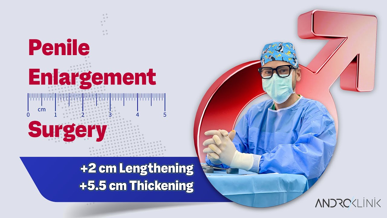 Penile Enlargement Surgery (+2 cm lengthening, +5.5 cm thickening) - Dr. Evren ISIK