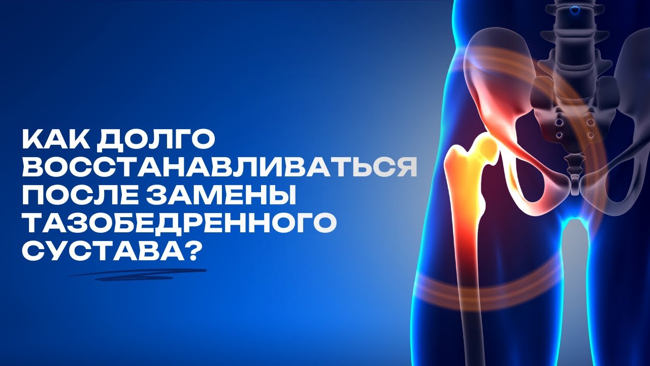КАК ДОЛГО ВОССТАНАВЛИВАТЬСЯ ПОСЛЕ ЗАМЕНЫ ТАЗОБЕДРЕННОГО СУСТАВА? 