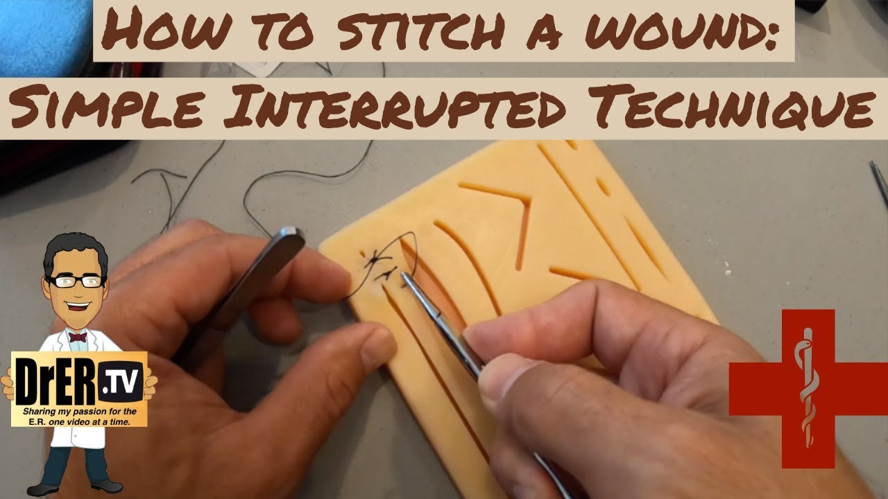 Simple Suture Repair - How to suture