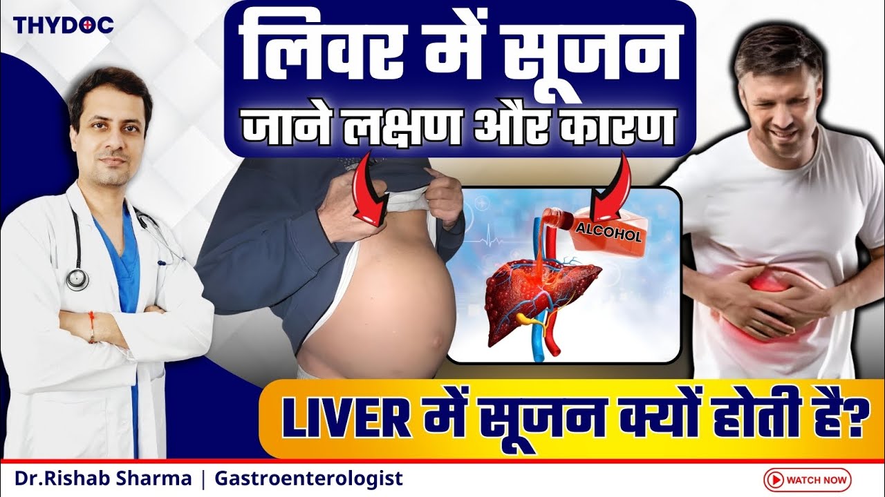 लिवर में सूजन के लक्षण और कारण | लिवर की सूजन के क्या हैं लक्षण ? | Liver Disease In Hindi