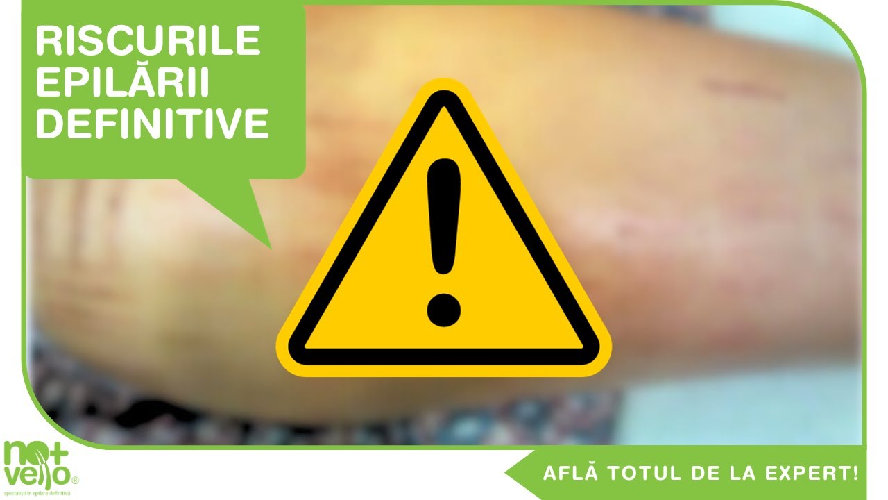 Epilarea definitiva: RISCURI si Contraindicatii | Evita Iritatia!