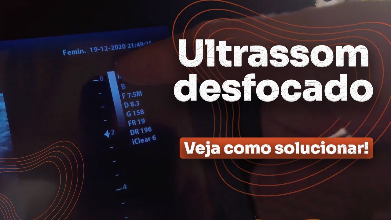 Como ajustar o foco do ultra-som, um passo a passo que usamos sempre.
