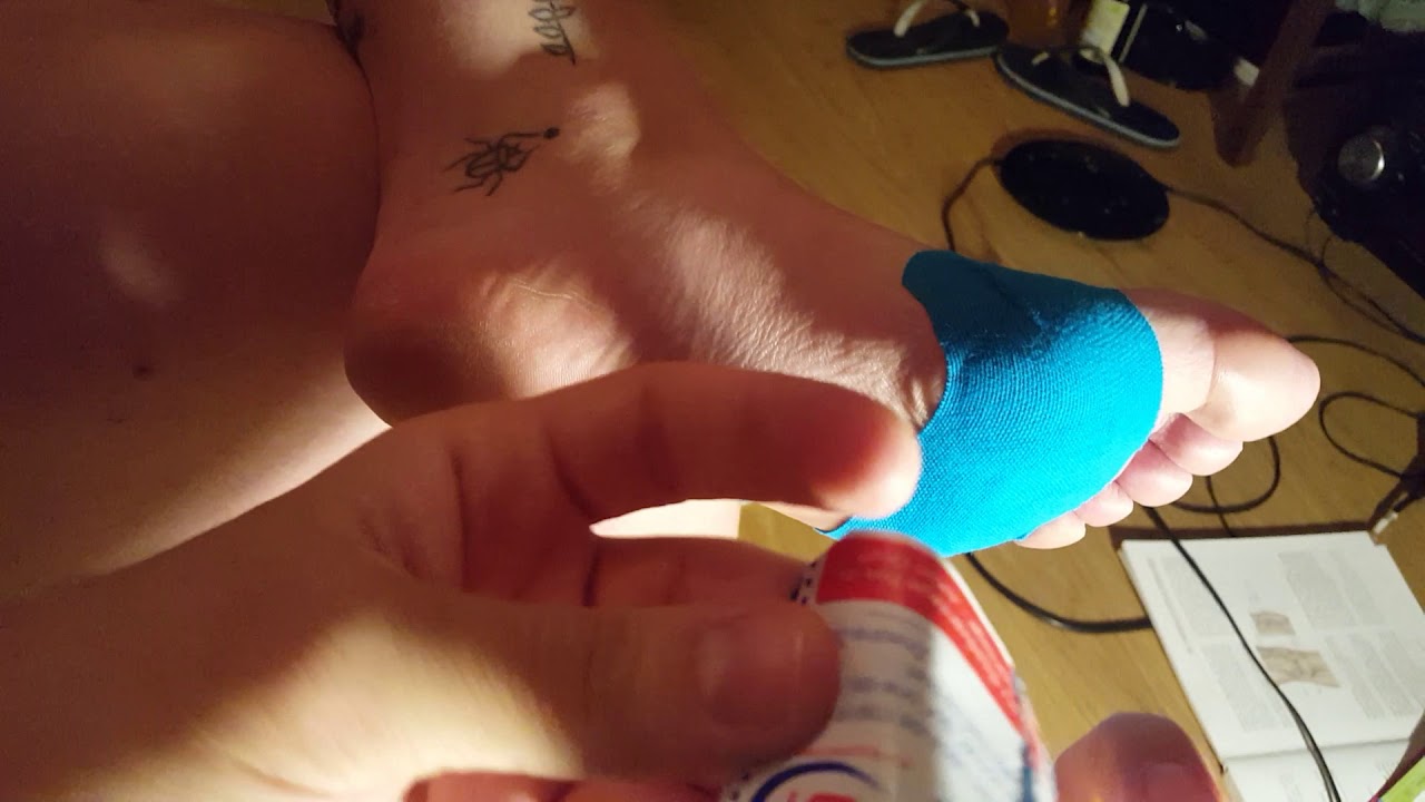 KT tape for metatarsalgia VK