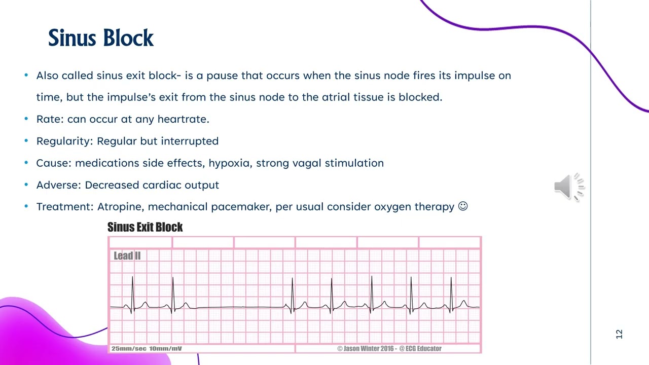 Week 7 Rhythms originating in the sinus node