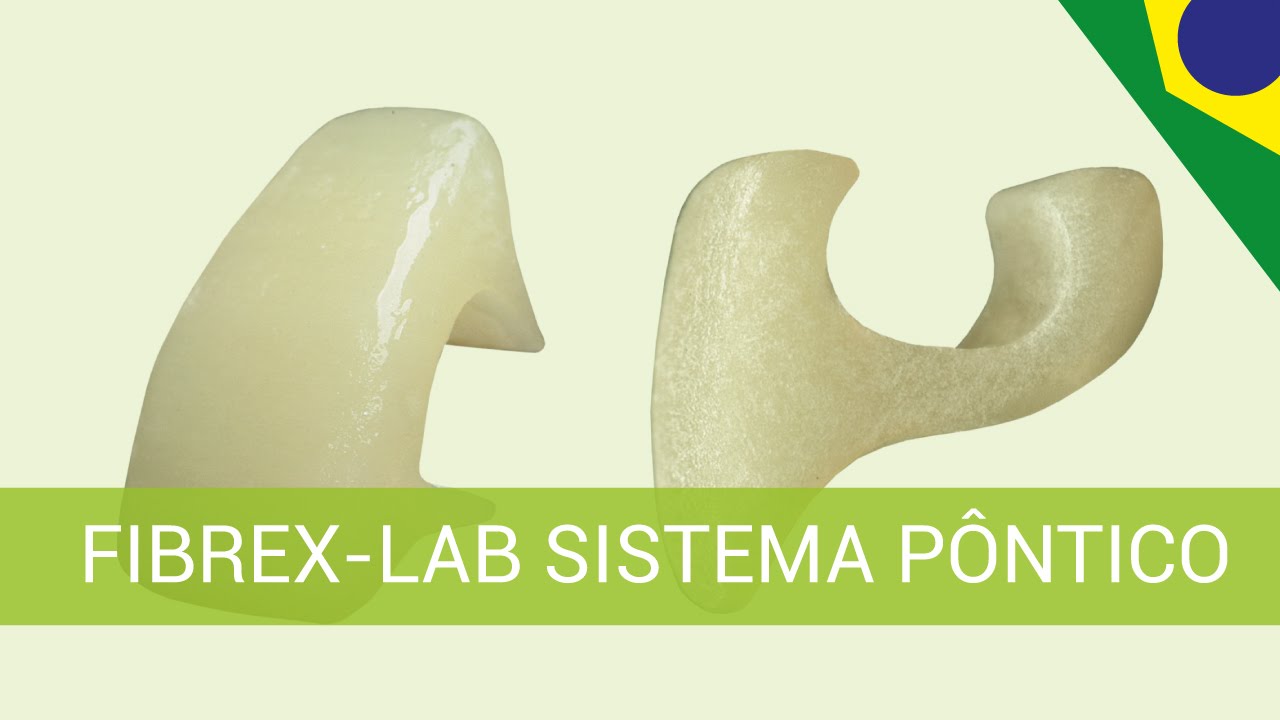 LABORATORIAL - Fibrex-Lab Sistema Pôntico