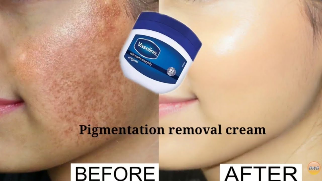 Vaseline for face pigmentation overnight | Vaseline on face at night benefits | Vaseline on face